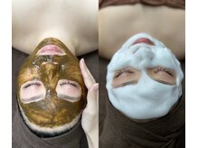ヴィノ(VINNO)の雰囲気（お肌の根本的改善が出来るのでお肌悩みがない赤ちゃん肌へ♪）