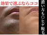 朝の身支度の時短に役立つヒゲ脱毛【メンズ脱毛ダントツNo.1】お得な回数券有