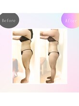 リアン(Lien)/before after