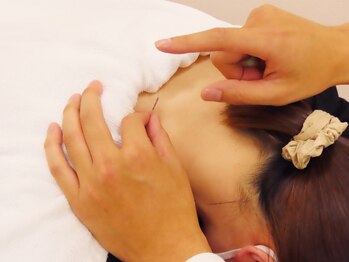 ほねつぎ月が丘はりきゅう接骨院の写真/気になる箇所を重点的にケア◎身体の不調やお悩みに合わせた鍼灸施術でスッキリ解消☆