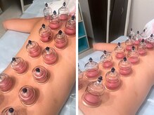 ビューティースタジオ韓美 いわき平/施術後のスッキリ感が病みつき！