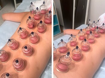 ビューティースタジオ韓美 いわき平/施術後のスッキリ感が病みつき!