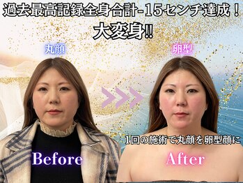 ミーアキャット 福岡天神(MEERKAT)/全身合計-15センチ達成