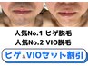 【 30日以内の再来 】ヒゲ＋VIO脱毛 ♪