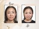 チチ(Chichi)の写真