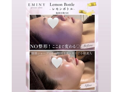 エミニー(EMINY)の写真