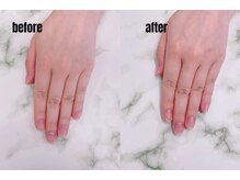 アール アンド シー(R&C)/ケア(甘皮ケア)