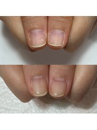 傷み爪の自爪風育成ジェルネイル