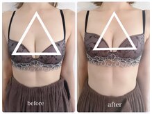 シェリアン(Cherien)/バストケア