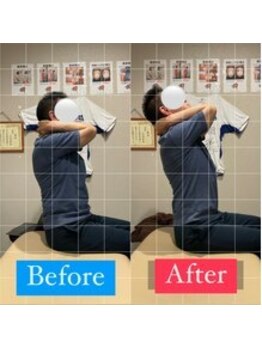 ナオル整体 宮崎院(NAORU整体)/50代男性施術事例【姿勢改善】