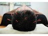 【9月限定】《頭の疲れをリフレッシュ》　頭皮鍼60分6500円→4000円