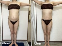 エカンブロン(EcrinBlanc)