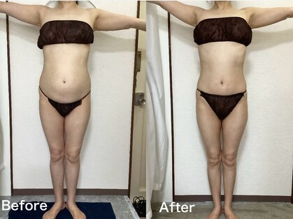 エカンブロン(EcrinBlanc)の写真