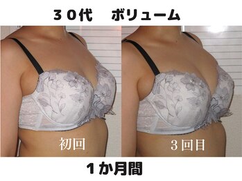 バストサロン メルベイユ(Merveile)/ボリューム、谷間、立体感UP
