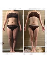 エムズ ビューティー サロン(M's Beauty Salon)/ビフォーアフター