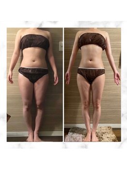 エムズ ビューティー サロン(M's Beauty Salon)/ビフォーアフター