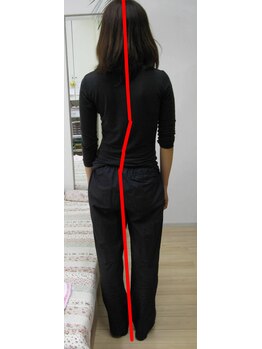 エスコート芦屋サロン/20代 女性 側湾 骨盤の歪み