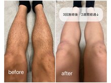 ルーフの雰囲気（学生証のご提示で500円off/中学生までの脱毛キッズメニューあり）