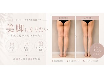 ビオール 池袋店(beall)の写真/韓国製「キャビ吸引」で徹底アプローチ◎頑固な太ももの脂肪にもう悩まない♪お得な限定クーポン多数