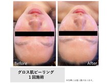 ブオン(Buom)の雰囲気（１回の施術でも効果抜群！！）