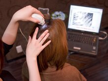 ココ 成田店(COCO)/育毛促進　頭皮診断