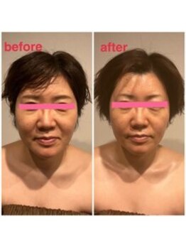 グレースフィオーレ 南越谷店(gracefiore)/小顔｜毛穴｜肩こり改善