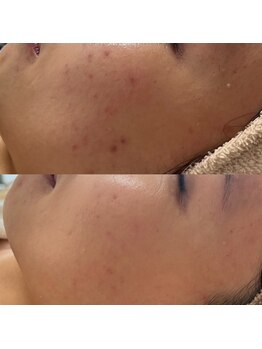 リュミエール(LUMIERE)/たった4ヶ月で！！