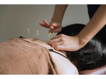 フィット鍼灸整骨院 ぶばい院/【肩こり改善】