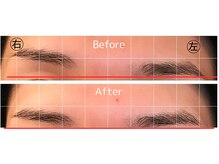アレセ 表参道/眉毛位置矯正