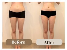 アムール(Amour)/反り腰、Ｏ脚悩み｜30代女性