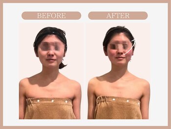 スリムライン 八戸店(The Slim Line)/before→after