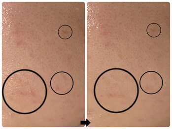 エフェクト 塚口店(effect)/before after