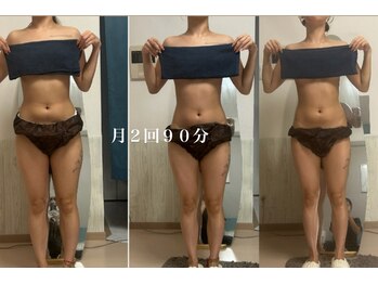 オーシャンブルーム 目黒(OceanBloom)/ハイパーナイフ/浮腫み