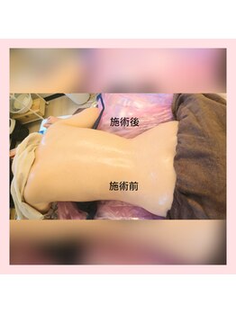 ヨリーズサロン(yoris.salon)/クビレむくみ解消お任せ下さい◎