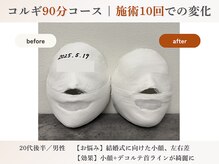 エルマ(elma)/コルギ90分before&after