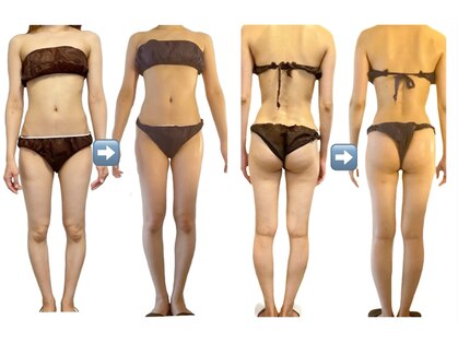 広尾痩身ビューティーサロンの写真