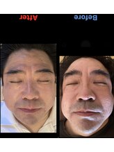 精神と時の部屋/5回でここまで！(かなりの剛毛)