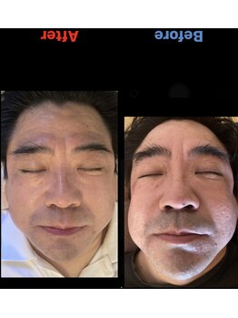 精神と時の部屋/5回でここまで！(かなりの剛毛)