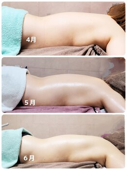 ソエルテ(Soelte)/サイズダウンへ導くリンパケア