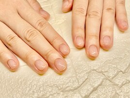 【B17】クリアネイル