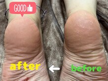 ギャラクシービューティー(galaxy beauty)/脚すっきり！