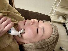 整体院まるも/表情筋をEMS