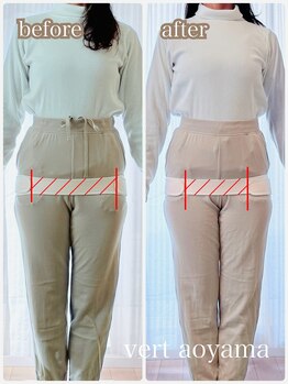 ヴェール 青山(vert)/骨盤矯正は、いつ受けても大丈夫