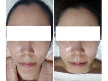 ミュー(Mieux)/この変化に正直驚いています！