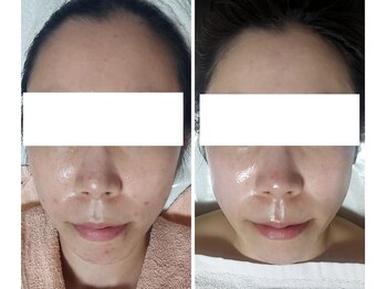 ミュー(Mieux)/この変化に正直驚いています！