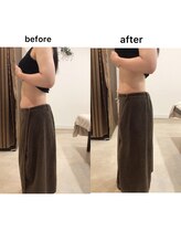 ジョワイユ(Joyeux)/腸の位置でお腹は変わる