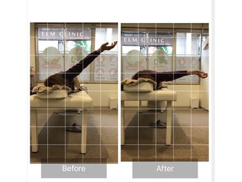 ナオル整体 熊本院(NAORU整体)/【70代女性施術事例 胸椎回旋】