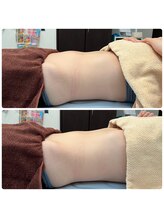 ビューティースタジオ韓美 いわき平/施術後にしっかり効果実感◎