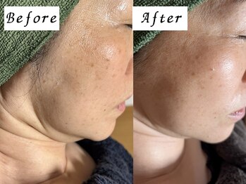 サロン ド エン(Salon de. en)/たるみ.シワに強いサロン