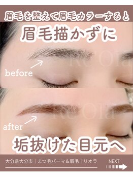 ニュートラル(neutral)/